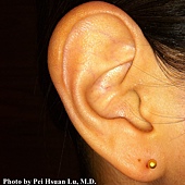 我的穿耳洞親身經驗-呂佩璇醫師-琢禾美學診所 HAUTE AGE-台北穿耳洞打耳洞診所